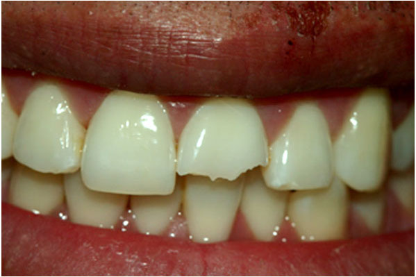 Lava Crowns Before 